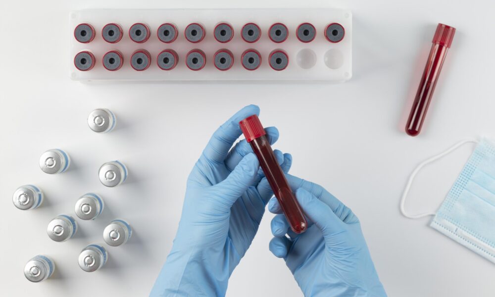 HBA1c testing at Ascent ae
