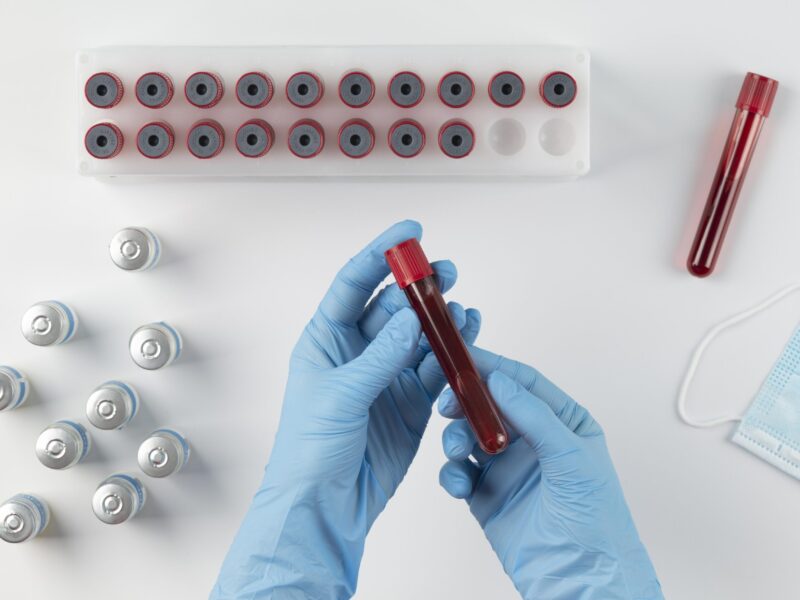 Understanding HbA1c: The Key to Long-Term Blood Sugar Control